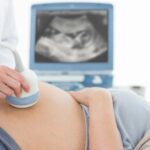 signs of autism on ultrasound